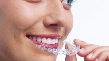 les-gouttieres-dalignement-460x295-1-380x215